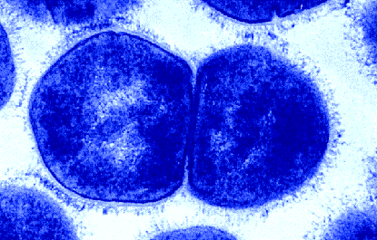 strep throat bacteria microscope